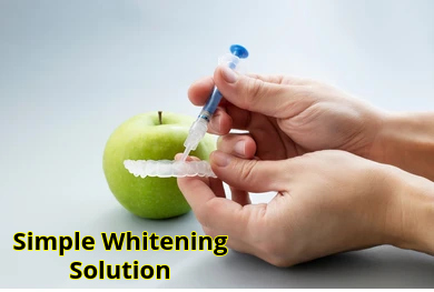 Teeth whitening