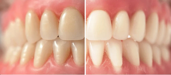 top dentist in Kolkata